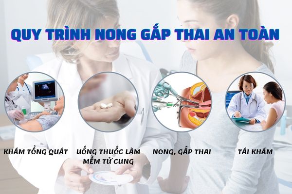 Nong gắp thai cần thực hiện theo quy trình để đảm bảo an toàn