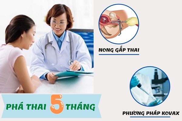 Phương pháp phá thai 5 tháng an toàn, hiệu quả