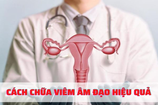 Cách chữa viêm âm đạo hiệu quả – Bảo vệ sức khỏe sinh sản nữ giới
