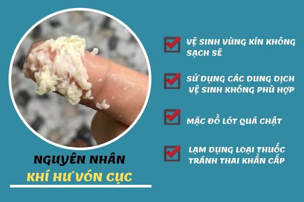 Khí hư vón cục do nhiều nguyên nhân khác nhau gây nên