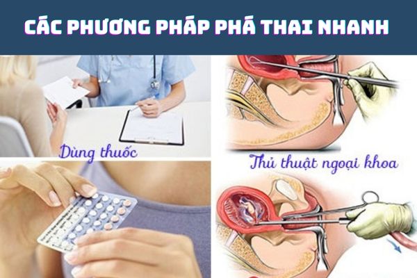 Các phương pháp phá thai nhanh đang được áp dụng phổ biến