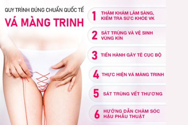 Quy trình vá màng trinh tiêu chuẩn