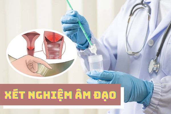 Xét nghiệm âm đạo – Phương pháp tìm ra nguyên nhân viêm nhiễm phụ khoa