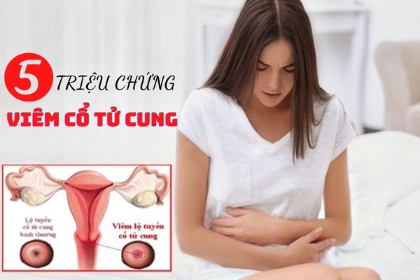 5 triệu chứng viêm cổ tử cung điển hình thường gặp ở nữ giới