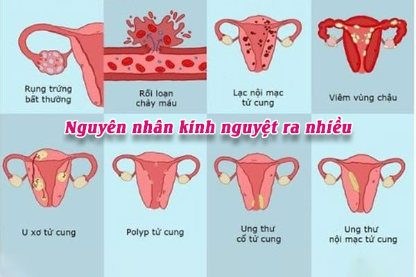 Kinh-ra-nhieu