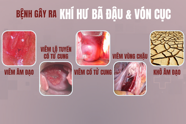 Luu-y-tinh-trang-khi-hu-ba-dau-va-von-cuc-1