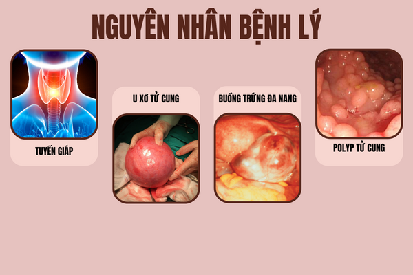 Nguyen-nhan-nao-khien-1-thang-den-2-lan-kinh-1