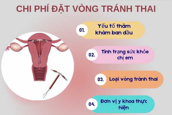 Chi phí đặt vòng tránh thai bao nhiêu còn phụ thuộc vào nhiều yếu tố