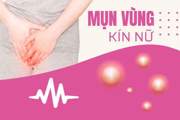 Noi-mun-vung-kin-nu-gioi-dung-lo-la-0