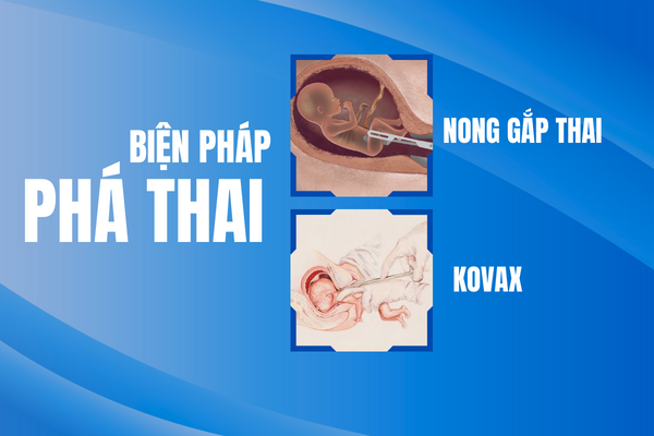 Pha-thai-4-thang-co-on-khong-1
