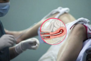 Hút thai 4 tuần có được không?