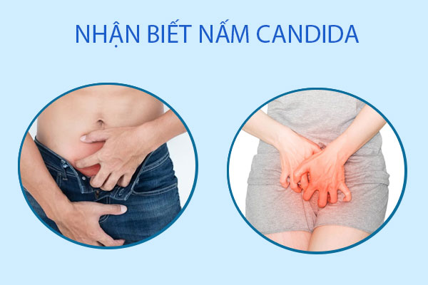Nhan-biet-nam-candida