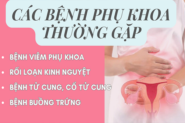 Top những căn bệnh phụ khoa chị em cần lưu tâm