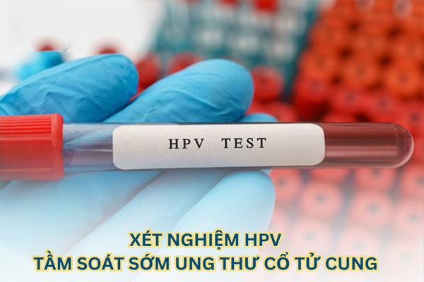 Chi phí kiểm tra HPV bao nhiêu còn phụ thuộc vào nhiều yếu tố ảnh hưởng khác