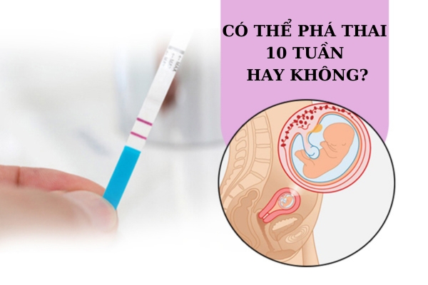 Có thể phá thai 10 tuần tuổi không?