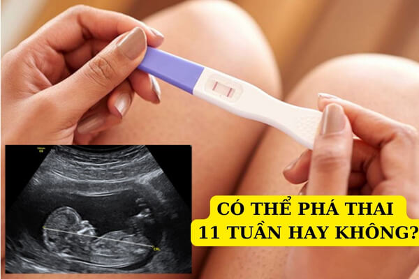 Có thể phá thai 11 tuần tuổi hay không?