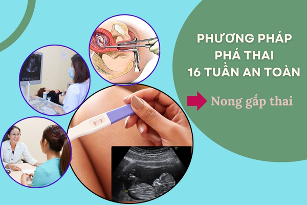 Phương pháp phá thai 16 tuần