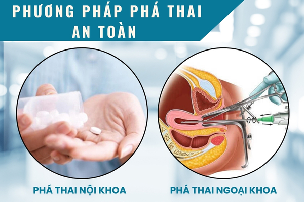 Các phương pháp bỏ thai an toàn