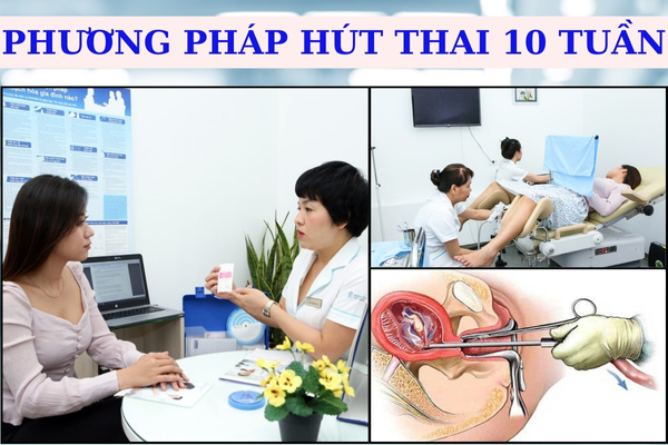 Hút thai 10 tuần