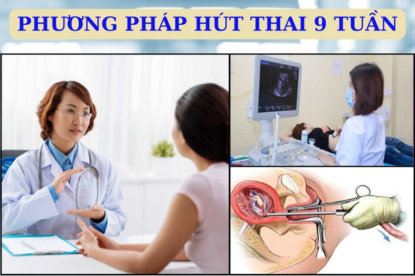 Hút thai 9 tuần