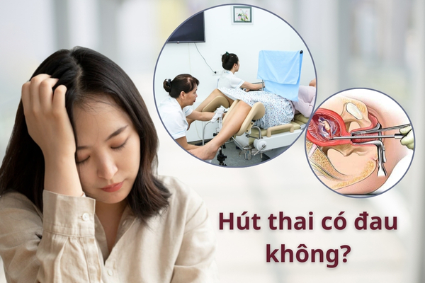 Hút thai có đau không?