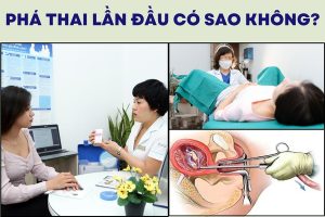 Phá thai lần đầu có sao không? Có gây vô sinh – hiếm muộn không?