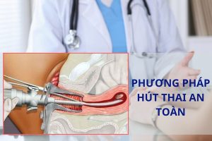 Hút thai 6 tuần có an toàn không?