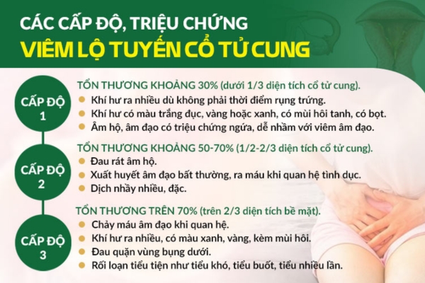 Cap-do-viem-lo-tuyen