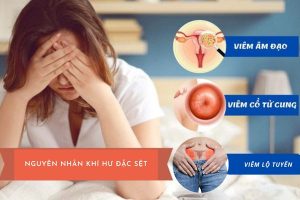 Khí hư đặc sệt và những nguyên nhân bệnh lý