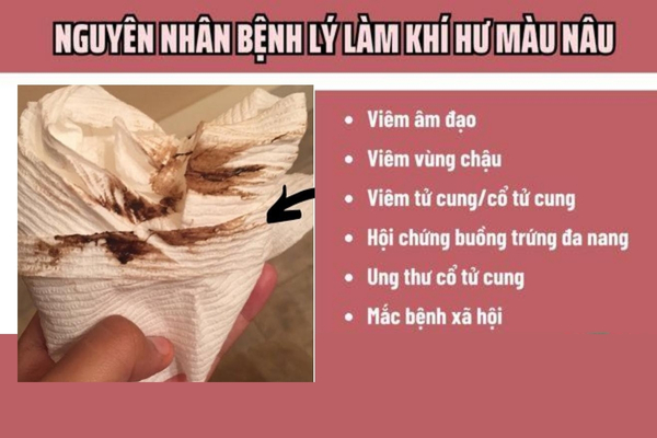 Nguyen-nhan-khi-hu-mau-nau (1)