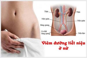 Dấu hiệu nhận biết viêm tiết niệu ở nữ