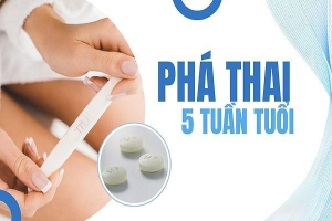 Phá thai 5 tuần ở đâu an toàn, kín đáo?