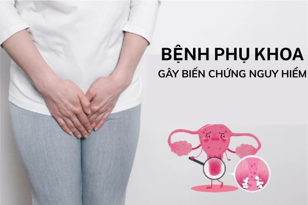 Benh-phu-khoa-kham-o-dau