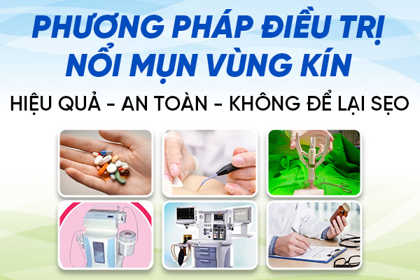 Chua-noi-mun-vung-kin