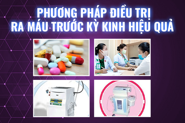 Chua-ra-mau-truoc-ky-kinh