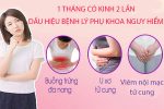 Nguyen-nhan-1-thang-co-kinh-2-lan