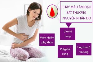 Chảy máu âm đạo bất thường nguyên nhân và cách điều trị tối ưu
