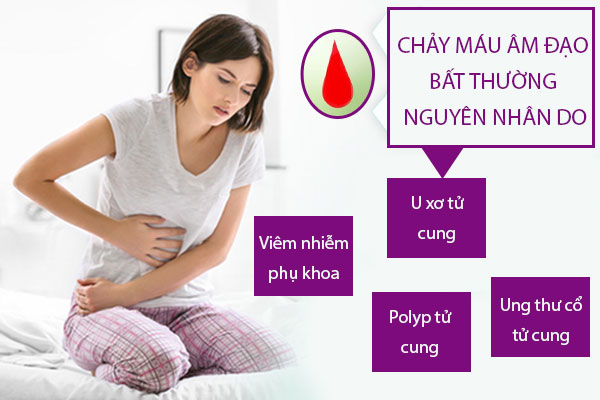 Nguyen-nhan-chay-mau-am-dao-bat-thuong