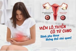 Dấu hiệu bị viêm lộ tuyến