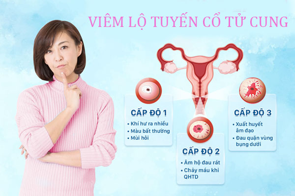 Viem-lo-tuyen-co-tu-cung