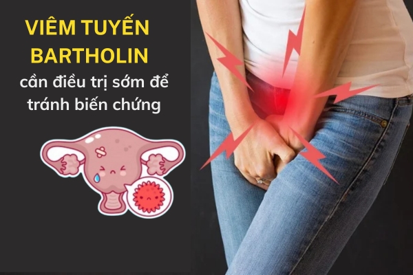 Viem-tuyen-bartholin