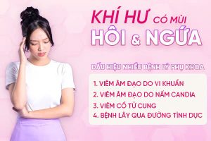 Khí hư có mùi hôi và ngứa – Hàng loạt chị em bất ngờ khi biết nguyên nhân