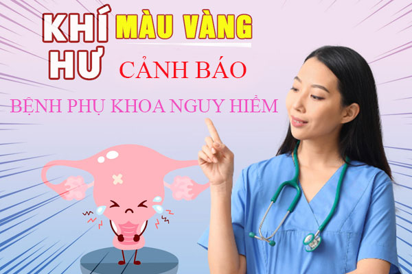Khi-hu-mau-vang