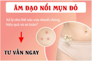 Âm đạo nổi mụn đỏ làm sao để mau hết?