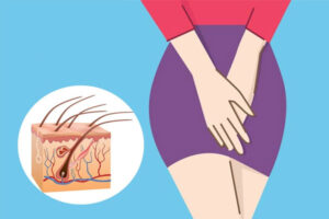 Đau vùng lông mu có sao không? Cách khắc phục hiệu quả?