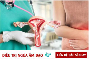 Điều trị ngứa âm đạo hiệu quả bằng cách nào?
