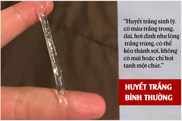 Huyet-trang-bi-hoi-1