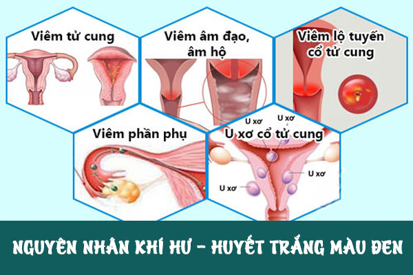 Huyet-trang-mau-den-1