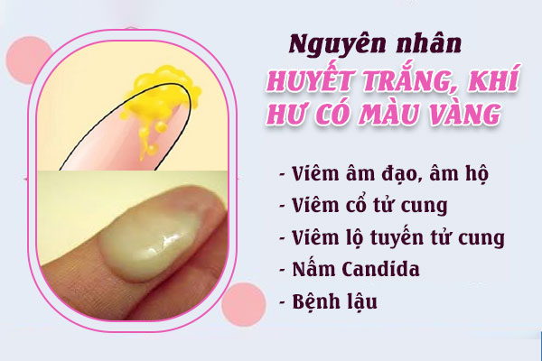 Huyet-trang-mau-vang-2