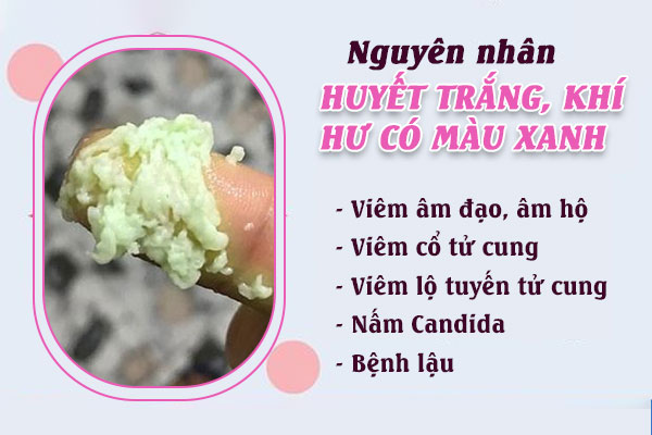 Huyet-trang-mau-xanh-1